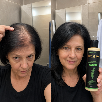 Lossless Shampoo (RS) 7