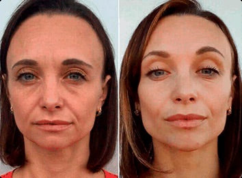 dsad (CO) 8